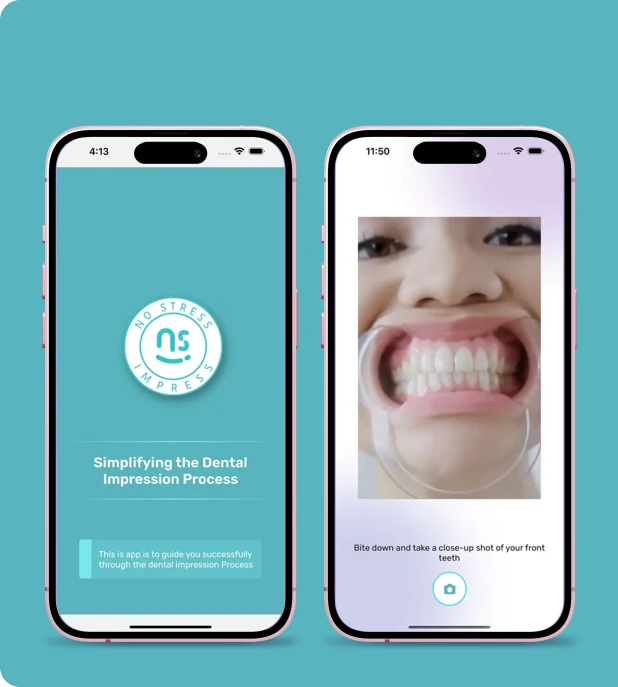 The No Stress Impress app shown on two phones