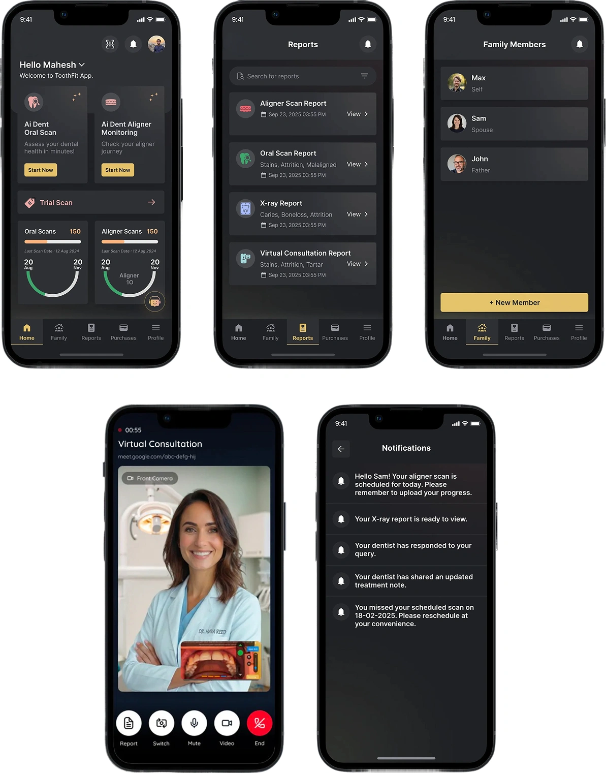 Five AI Dent app screens: the home dashboard with oral scan and aligner monitoring, a reports list, family members, a virtual consultation video call with a dentist, and notifications