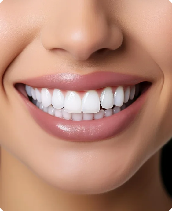 Close-up of a smile, the result the app is monitoring towards
