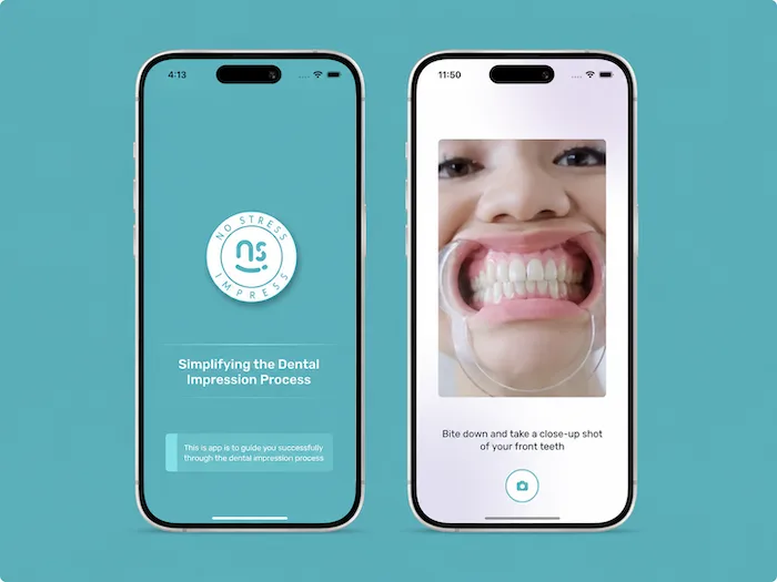 The No Stress Impress app shown on two phones